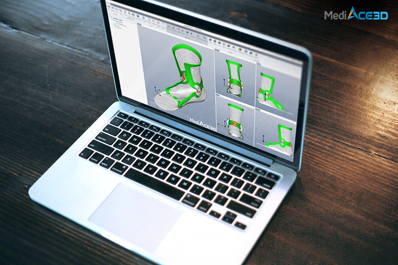 MediACE3D