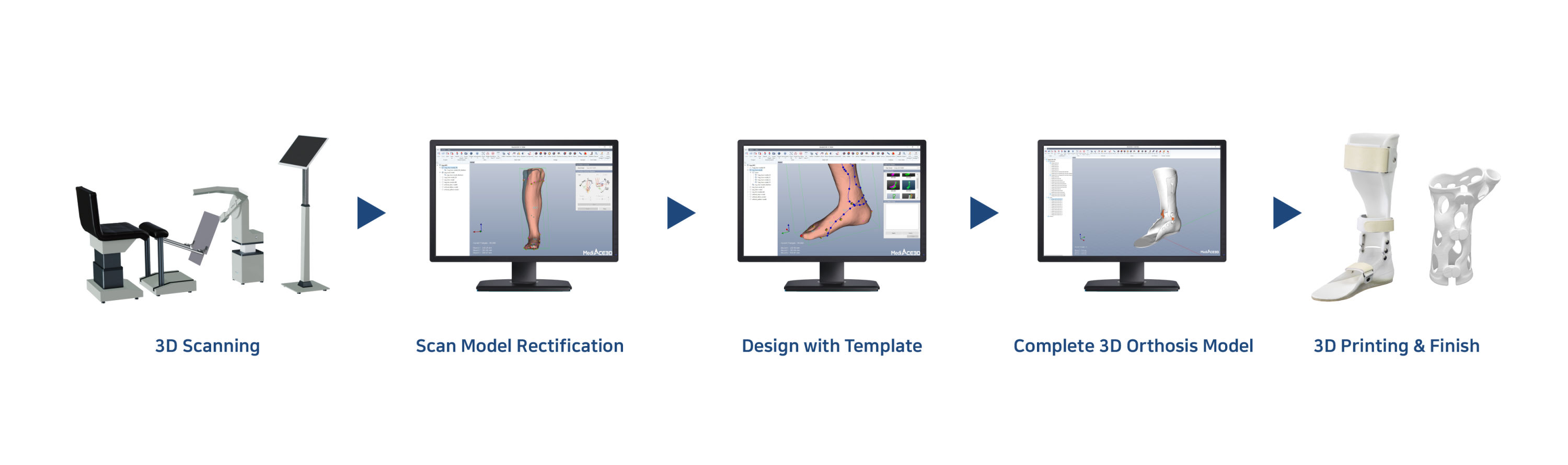 Additive Manufacturing System for Bespoke Orthosis